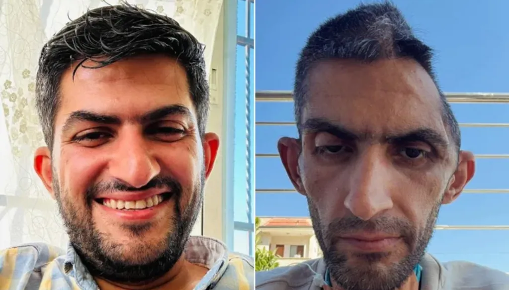 بعد اعتقاله في إسرائيل... فلسطيني يهز مواقع التواصل بصورة تُظهر تضرر جمجمته