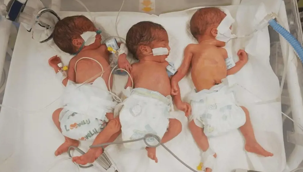 اليونيسف تحذّر من مخاطر سوء التغذية للحوامل والمرضعات في غزة