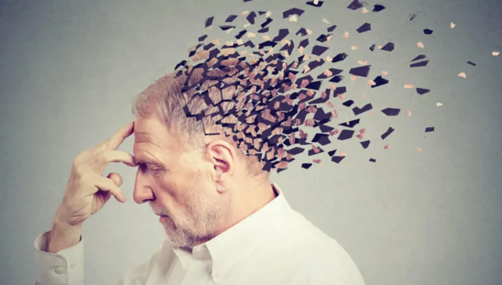 التغيرات الدماغية في مرض ألزهايمر تختلف حسب الجنس