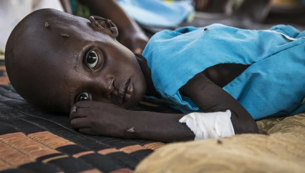 جنوب السودان... المعارك تمنع وصول المساعدات إلى 60 ألف طفل يعانون سوء التغذية