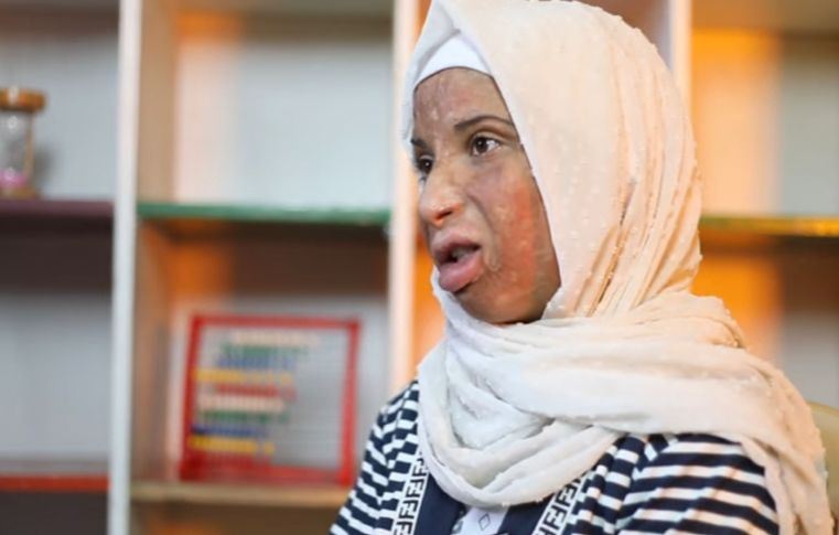 حرب وقتل وحريق في وجه الطفلة "الشجاعة" زمزم... "أنا مش بشعة" (فيديو)