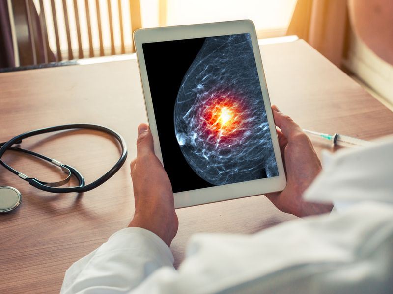 يزيد معدل العيش... الموافقة على أول علاج موجه لنوع جديد من سرطان الثدي