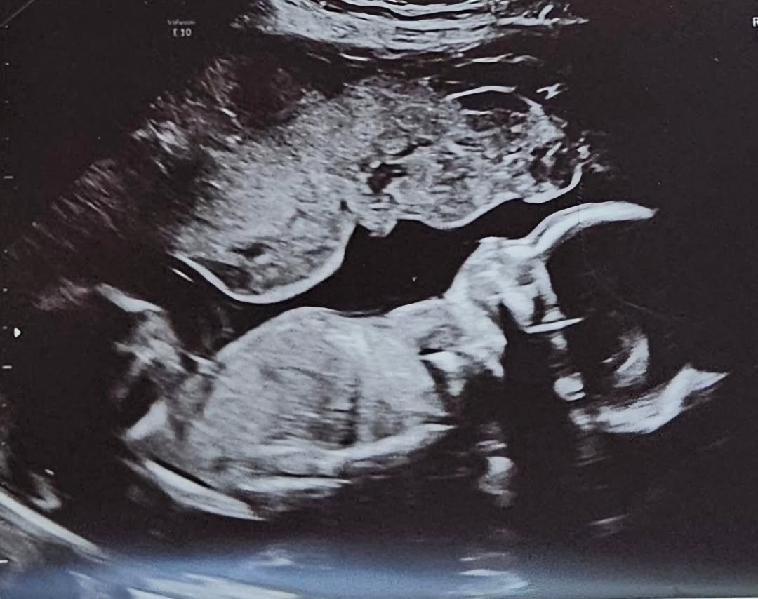 صورة فحص الرنين المغناطيسي الخاصة بالممثلة لورا أوريكو (من إنستغرام).