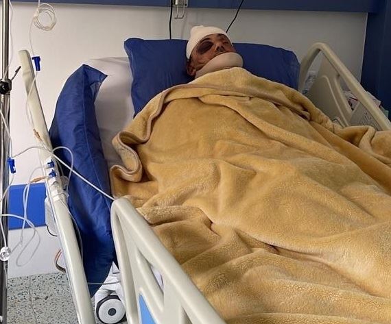 كسور في الجمجمة وبتر إحدى أذنيه... سمير صفير يقاضي إدارة أحد الفنادق في القاهرة
