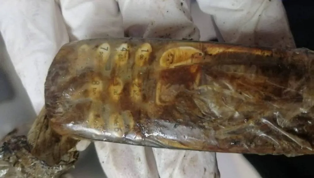 بعد عامين من ابتلاعه... "أبو لمبة" يخرج من بطن شاب مصري!
