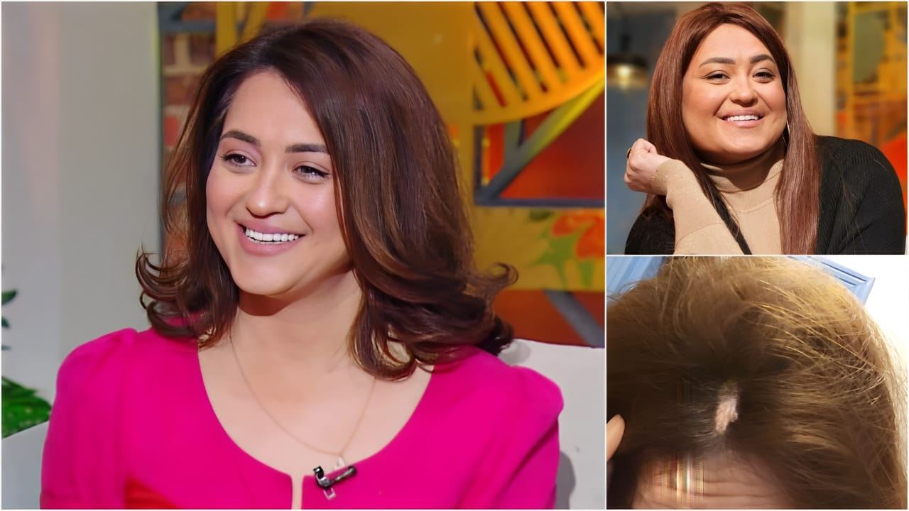 مروة عبدالمنعم تكشف تفاصيل أزمتها النفسية... فقدت وزنها وتساقط شعرها