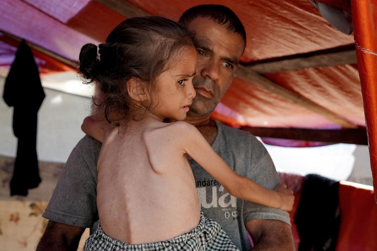 الصحة العالمية: سكان غزة يشربون مياه الصرف الصحي ويتناولون علف الحيوانات!