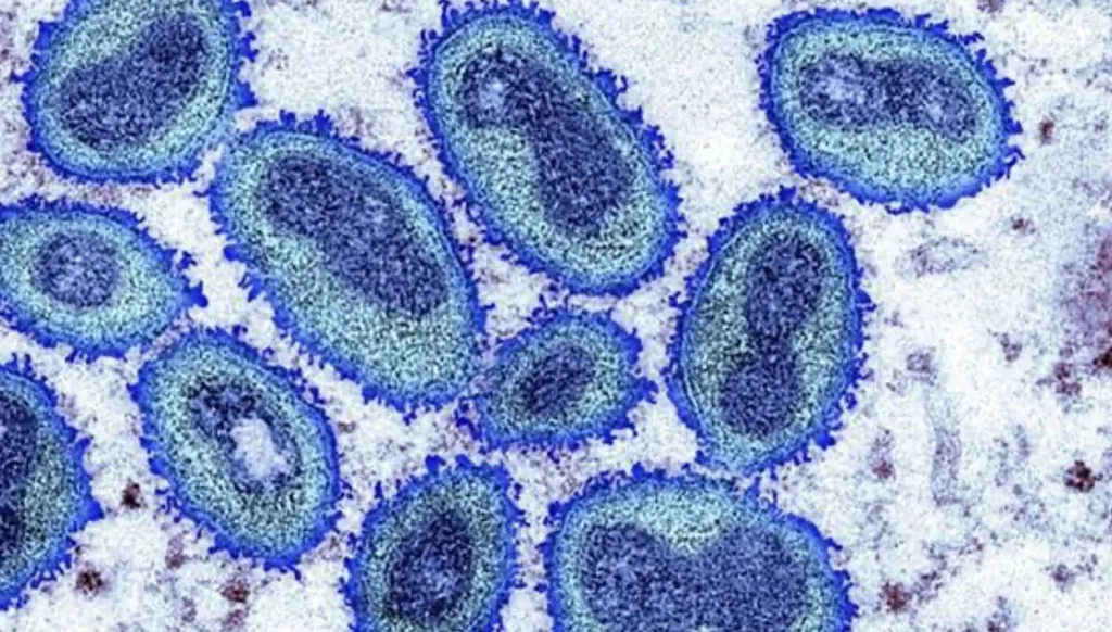 كندا تؤكد رصد أول إصابة بالسلالة الفرعية 1 من جدري القردة