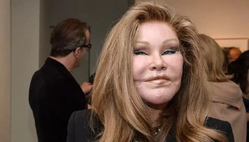 وفاة "المرأة القطة" جوسلين ويلدنشتاين عن 84 عاماً