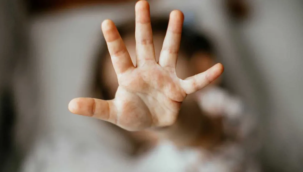 مقتل طفلة على يد والدها وزوجته... والعثور على شقيقها مصاباً بحروق