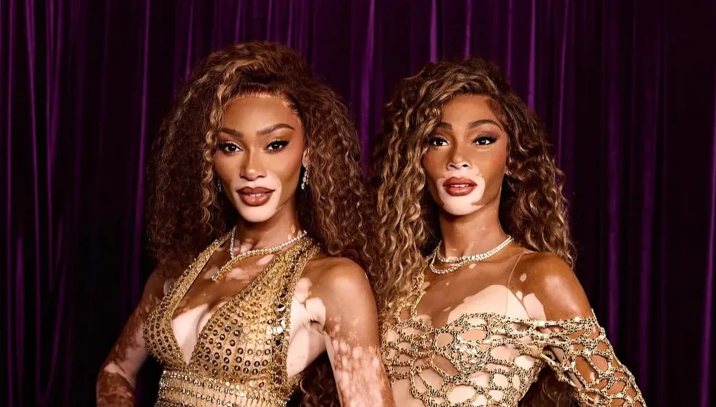 ويني هارلو في متحف مدام توسو بتصميم زهير مراد تزامناً مع يوم البهاق العالمي (صور وفيديو)