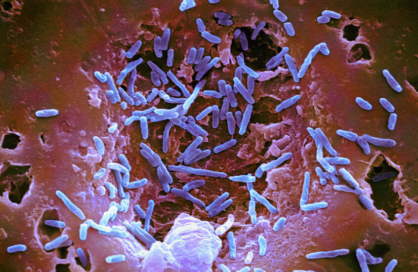 السالمونيلا. (تعبيرية)