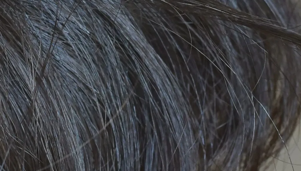 ما سرّ هوس نتف الشعر المرضي؟