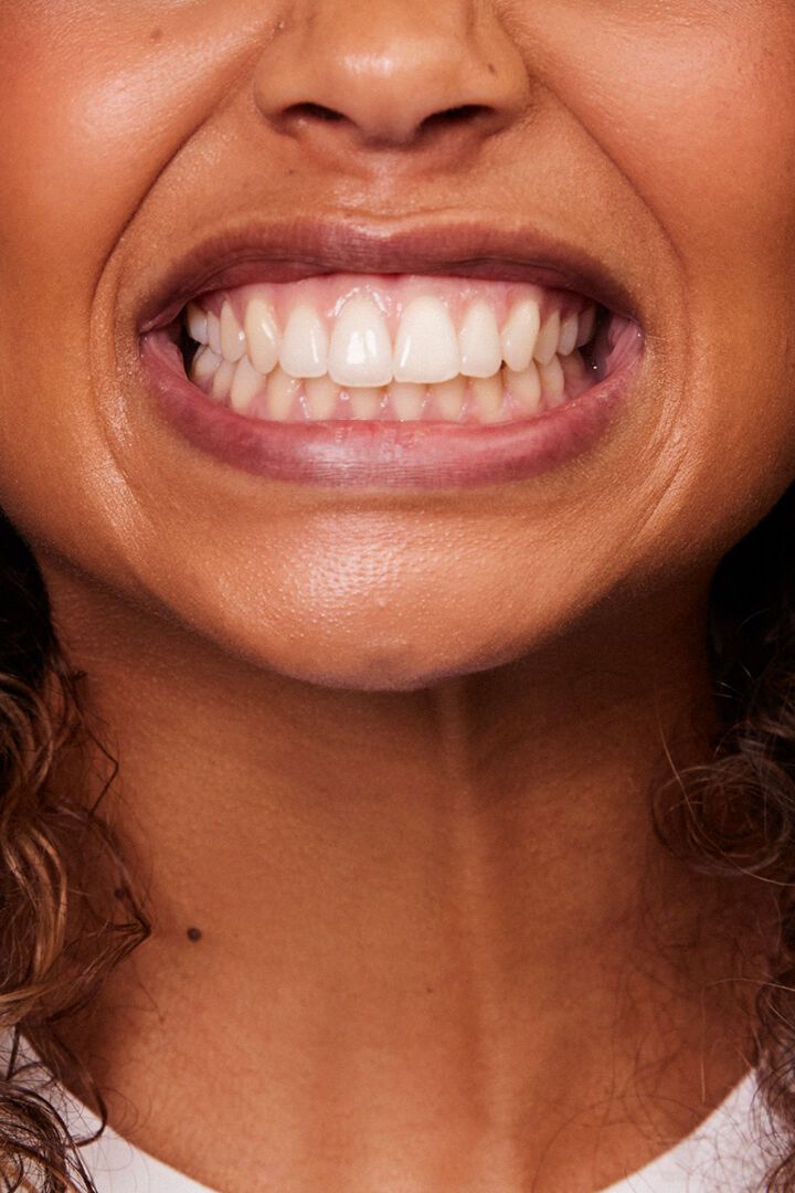 الضغط على الأسنان (Pinterest)