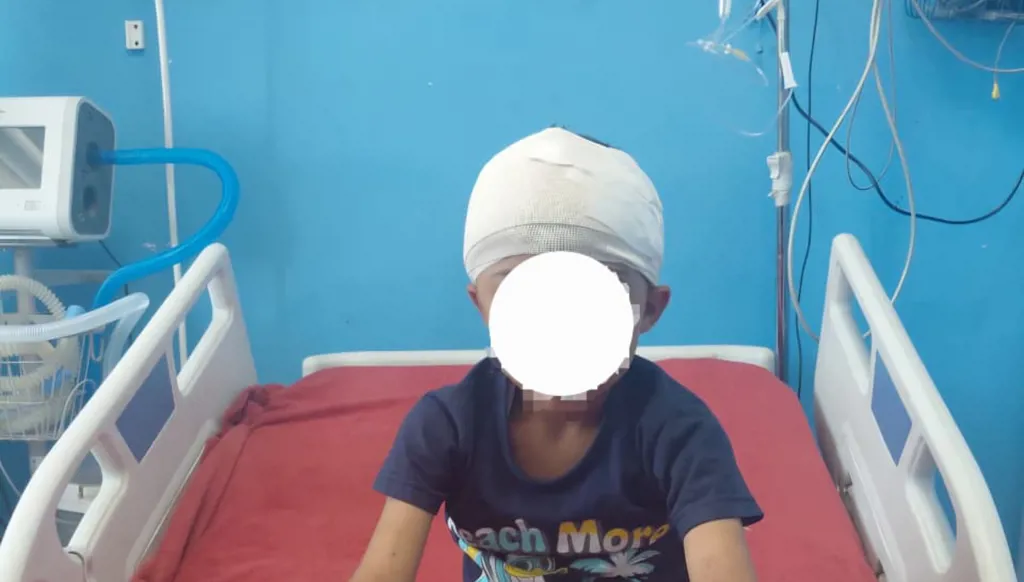 استخراج رصاصة طائشة من مخ طفل في مصر من دون مضاعفات