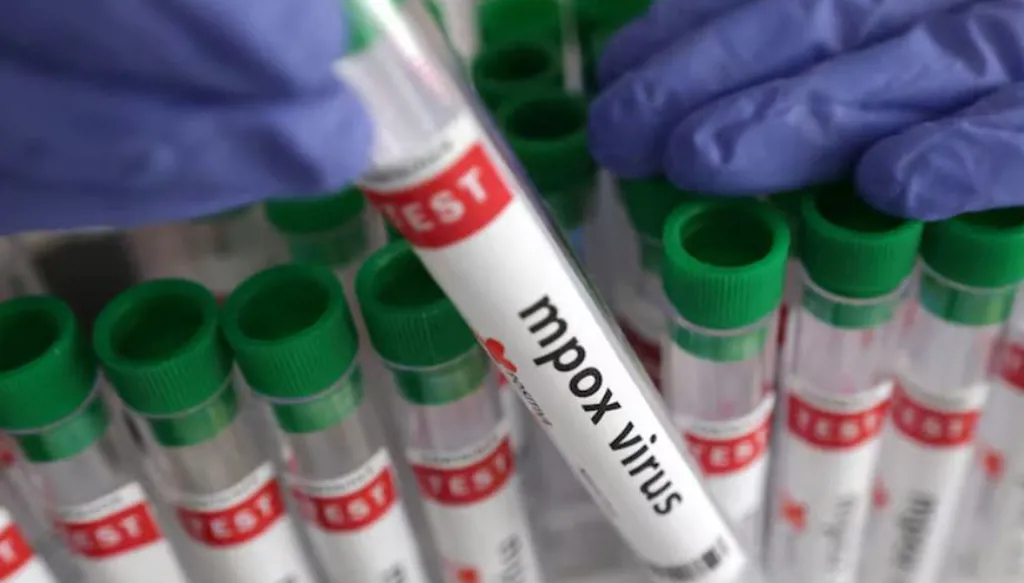 وزارة الصحة في نيويورك تؤكد أول إصابة بسلالة جدري القردة الجديدة