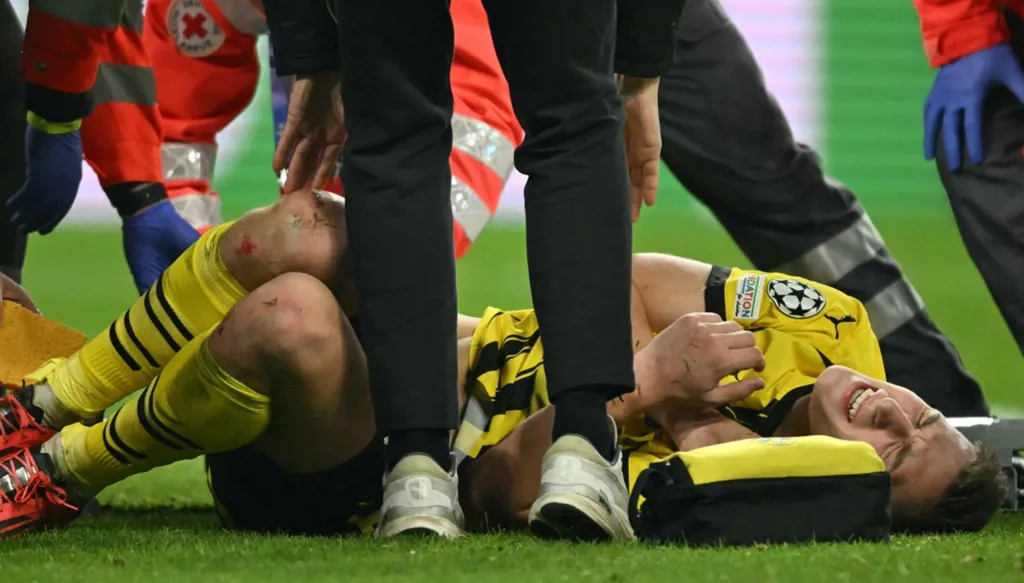 كشف تفاصيل إصابة شلوتربيك لاعب دورتموند