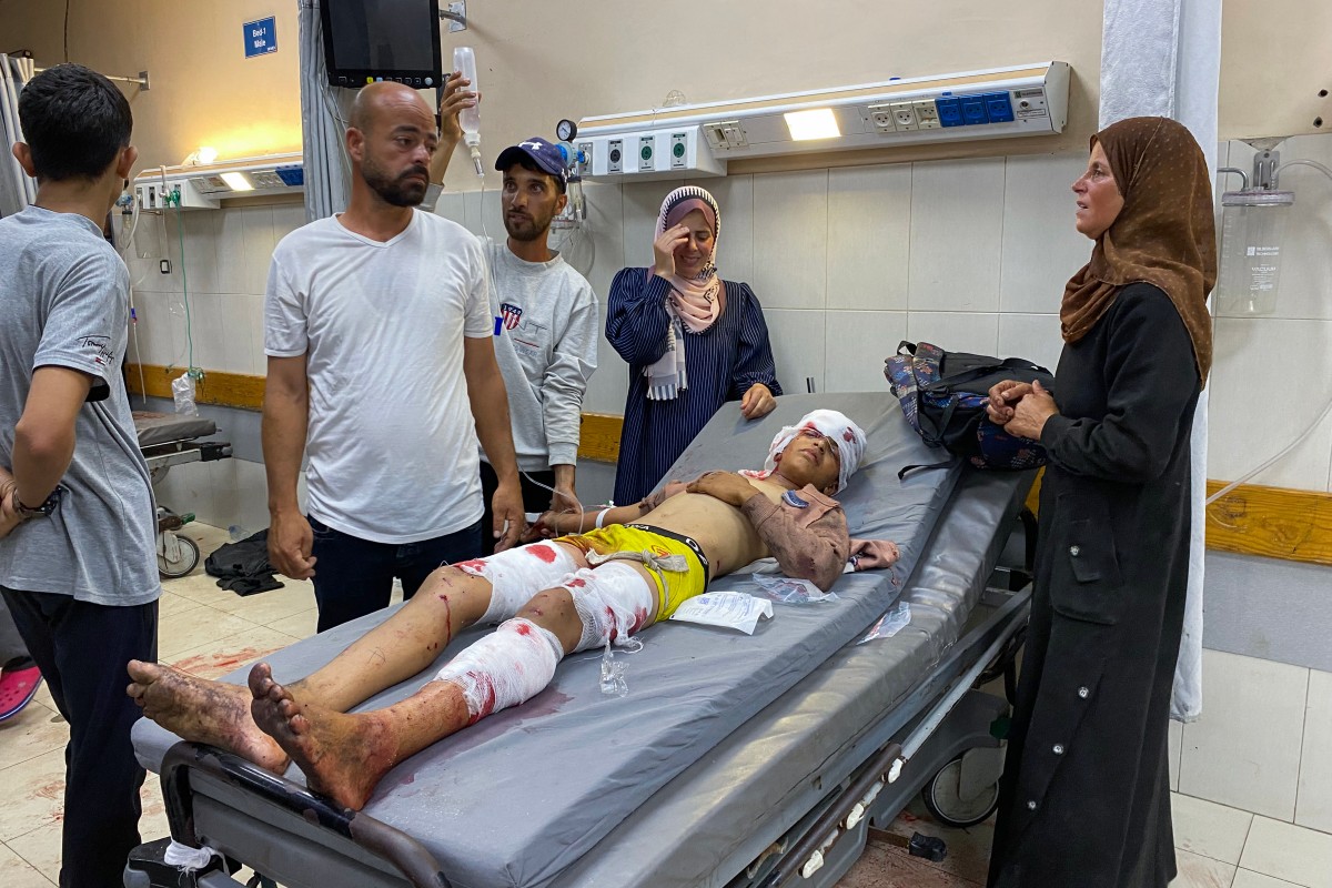 فلسطينيون أصيبوا بجروح يتلقون العلاج في مستشفى ناصر بخان يونس (ا ف ب)