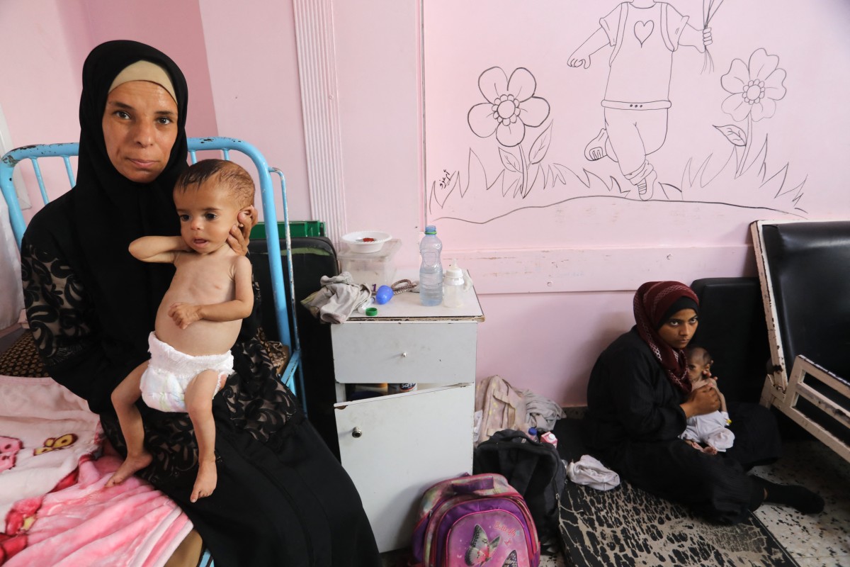 مجاعة في غزة (أ ف ب).