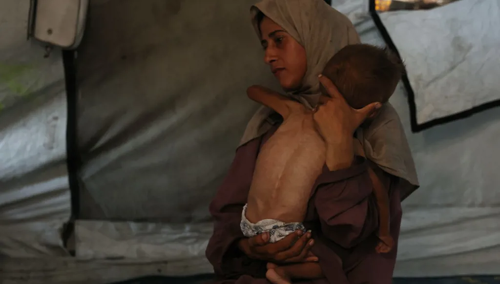 أطباء بلا حدود: ربع أطفال غزة يعانون سوء التغذية