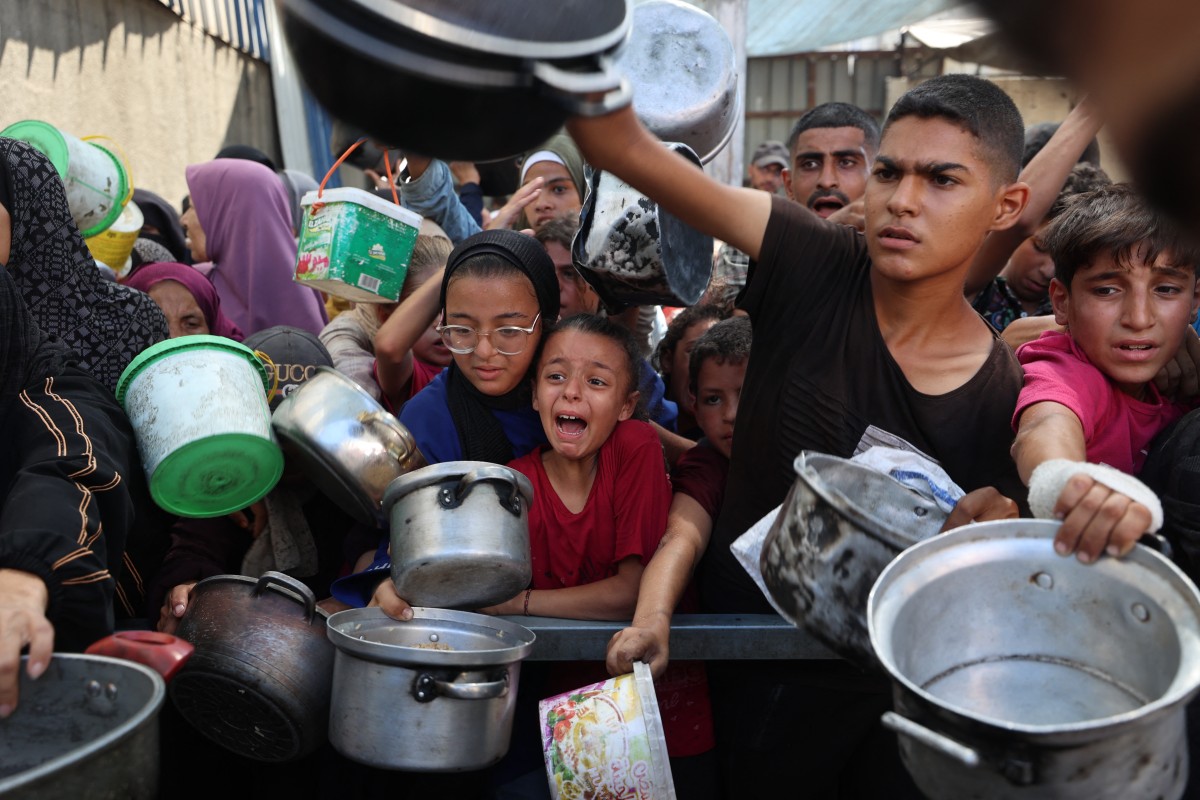 جوع في غزة. (أ ف ب)