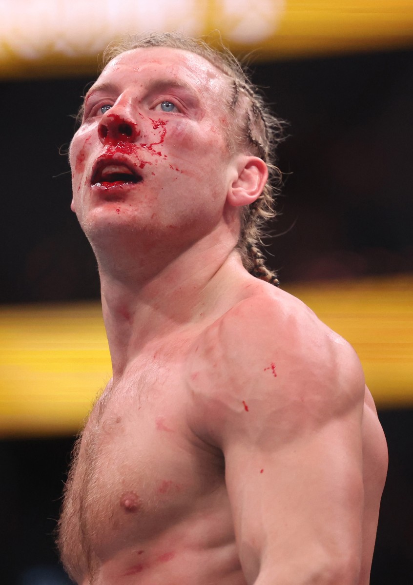 بيمبليت. (أ ف ب)