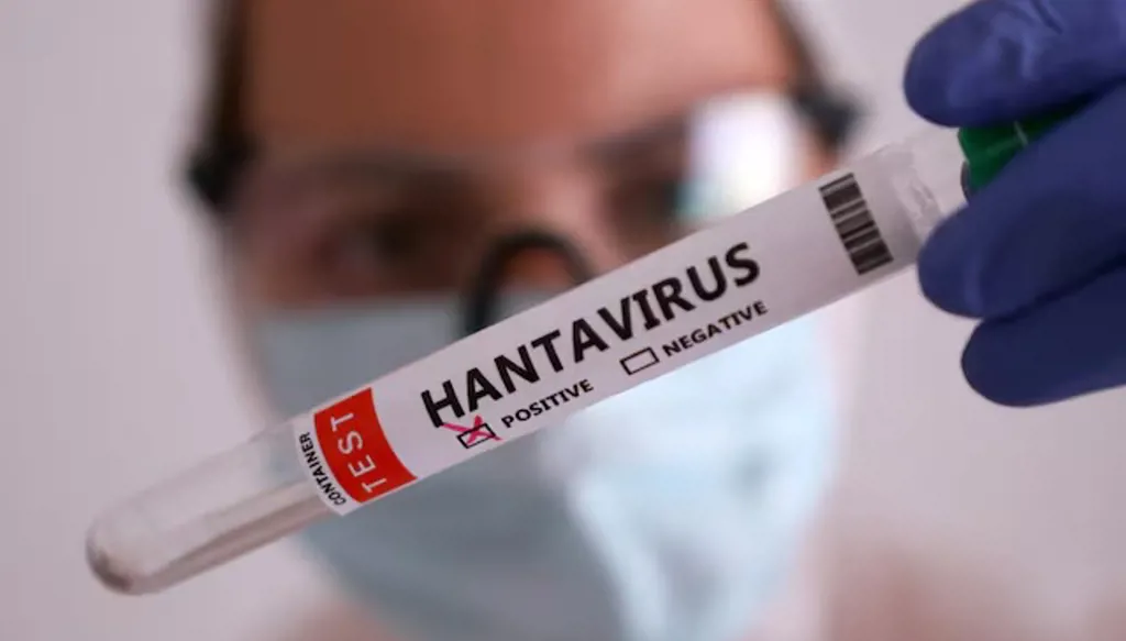 بريطانيا تعزل 22 من ركاب السفينة "هونديوس" بعد تفشي فيروس "هانتا" ونقلهم للمستشفى