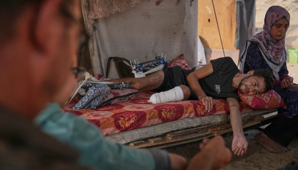 Gaza amputees struggle to rebuild lives as the enclave faces shortages of prosthetic limbs