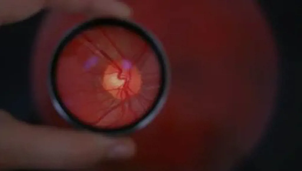 زراعة إلكترونية تعيد الأمل للمصابين بفقدان البصر