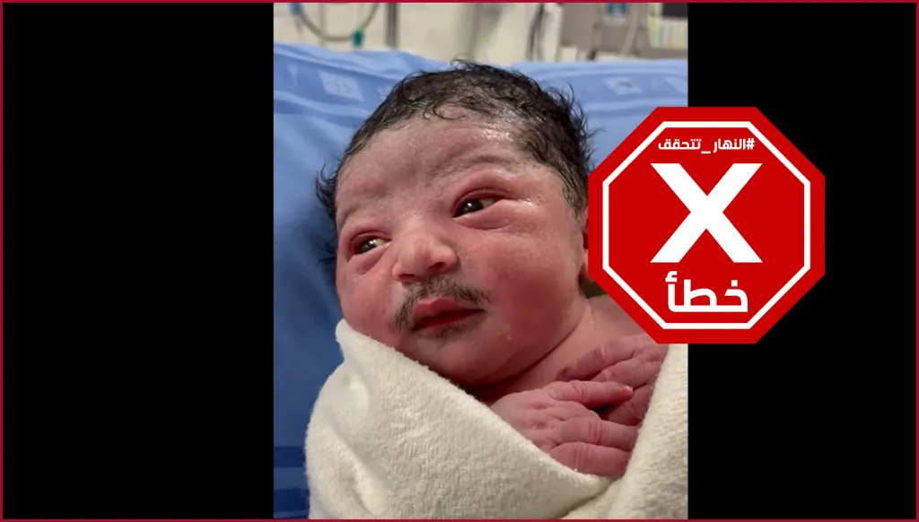 الأكثر تداولاً الآن... رضيع وُلِد بشارب؟ النهار تتحقق FactCheck