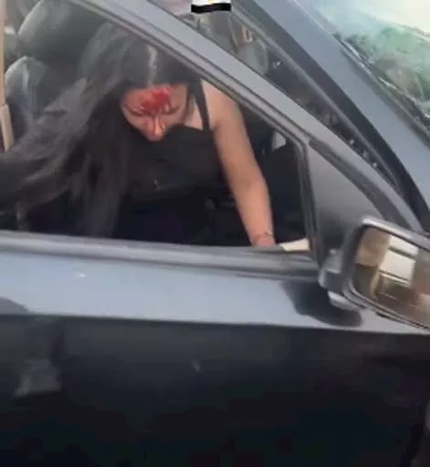 إصابة إحدى الفتيات بجروح في الرأس (أكس)