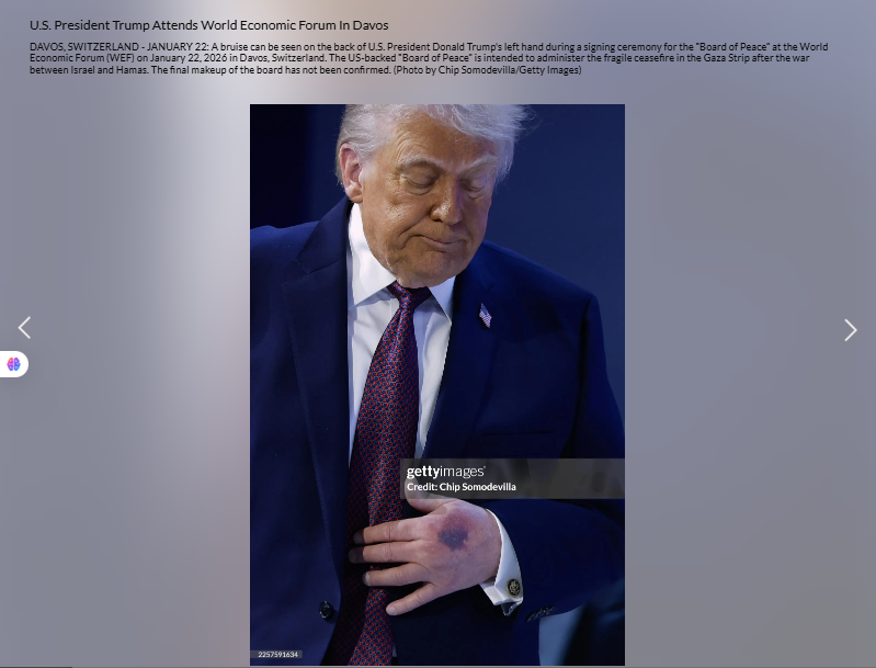 الصورة مؤرشفة في موقع وكالة غيتي ايماجيز في 22 كانون الثاني 2026