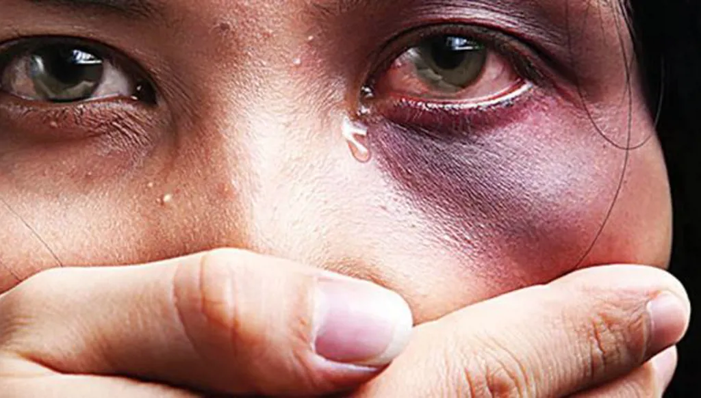 الأمم المتحدة: جرائم العنف الأسري تحصد امرأة كل عشر دقائق في العالم