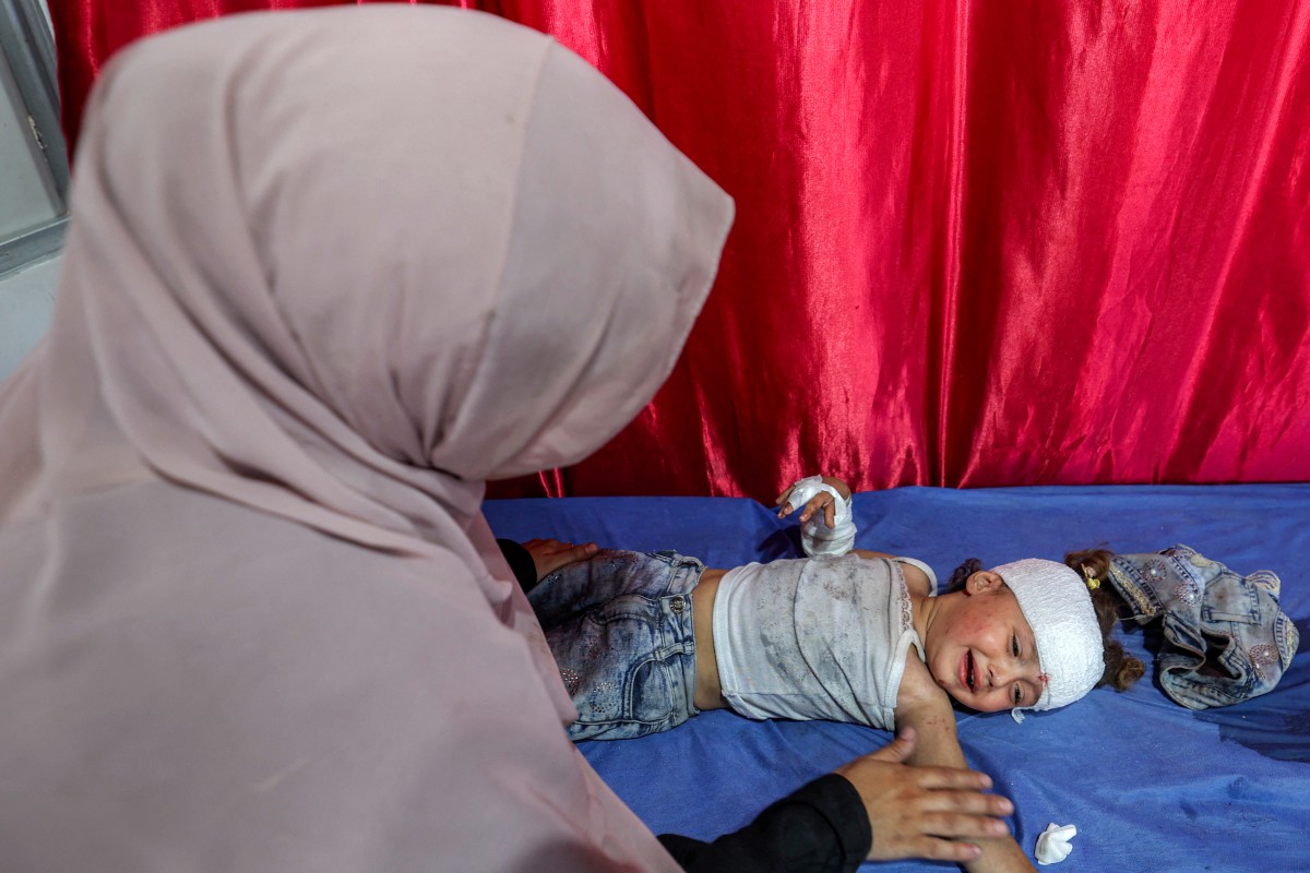 طفل مصاب بالقصف الإسرائيلي يتلقى العناية الطبية  (أ ف ب)‏