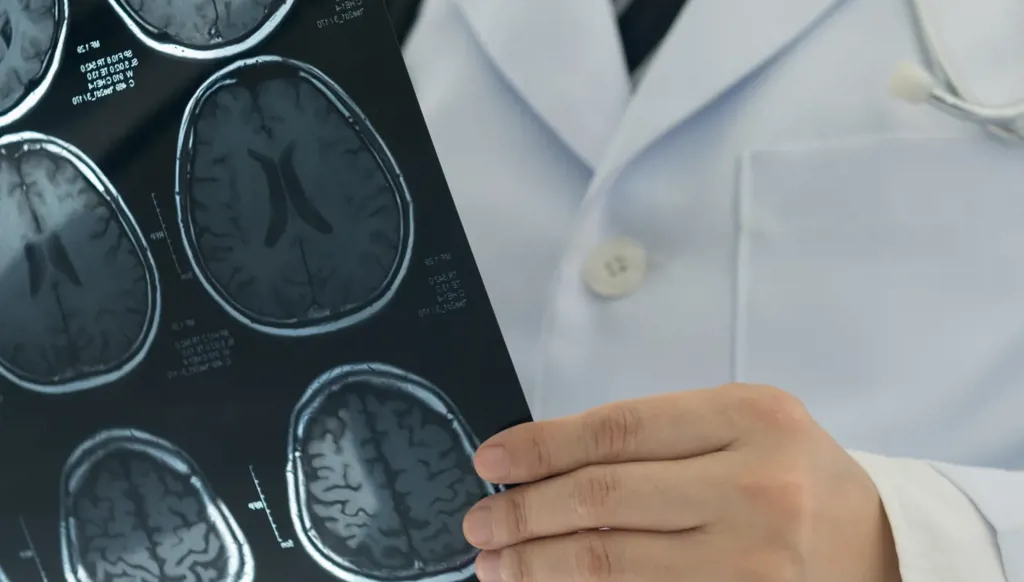 الذكاء الاصطناعي يعيد النطق إلى مرضى السكتة الدماغية