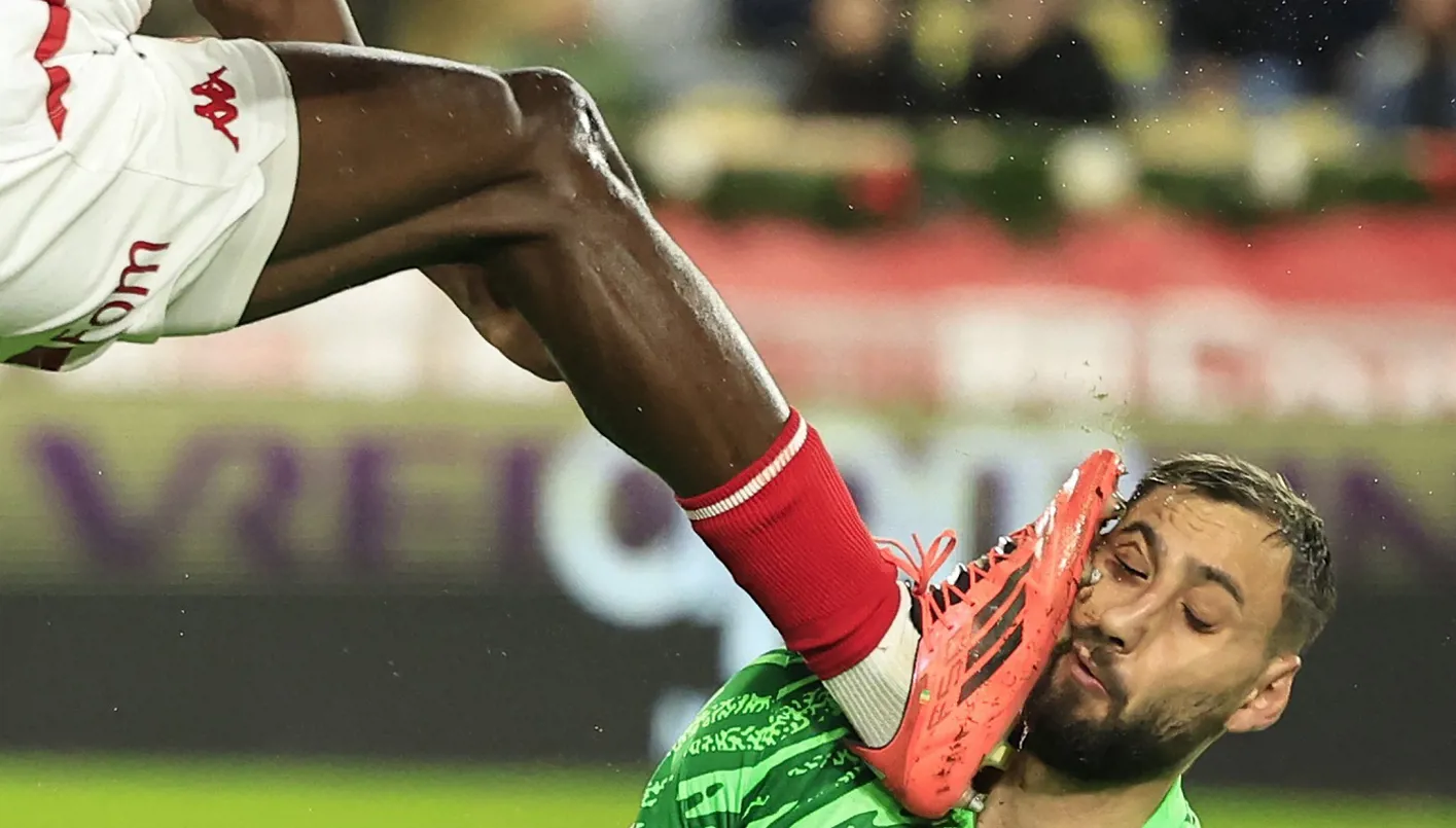 دوناروما يتعرض لإصابة مروعة في وجهه (فيديو)