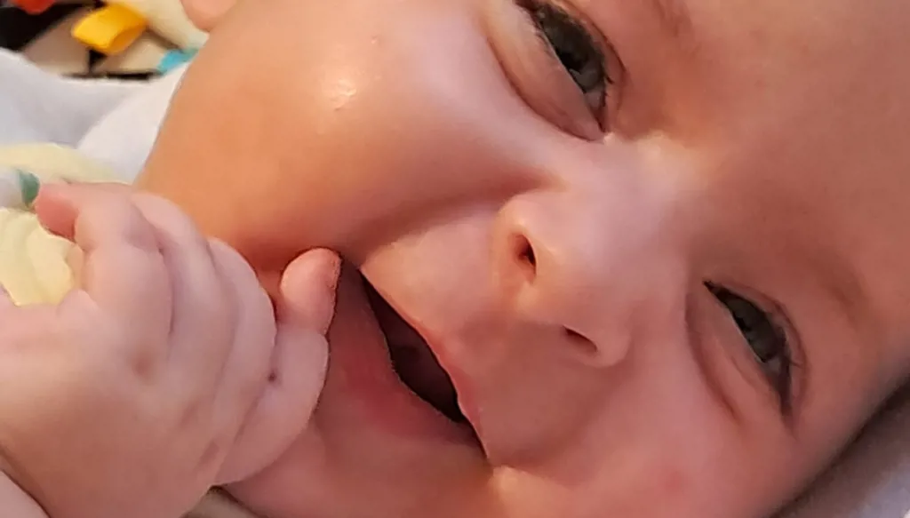 حالة إنسانية... لياندرا تصارع من أجل الحياة