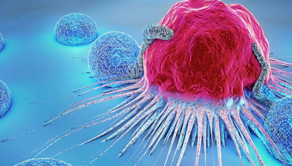 بحسب أكبر الدراسات... أطعمة يمكن تجنبها للوقاية من 5 أنواع من السرطان