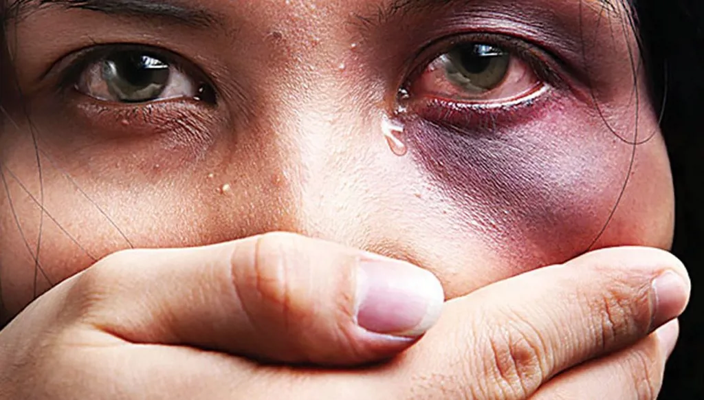 العنف ضد النساء في الحرب: مأساة الحماية المفقودة