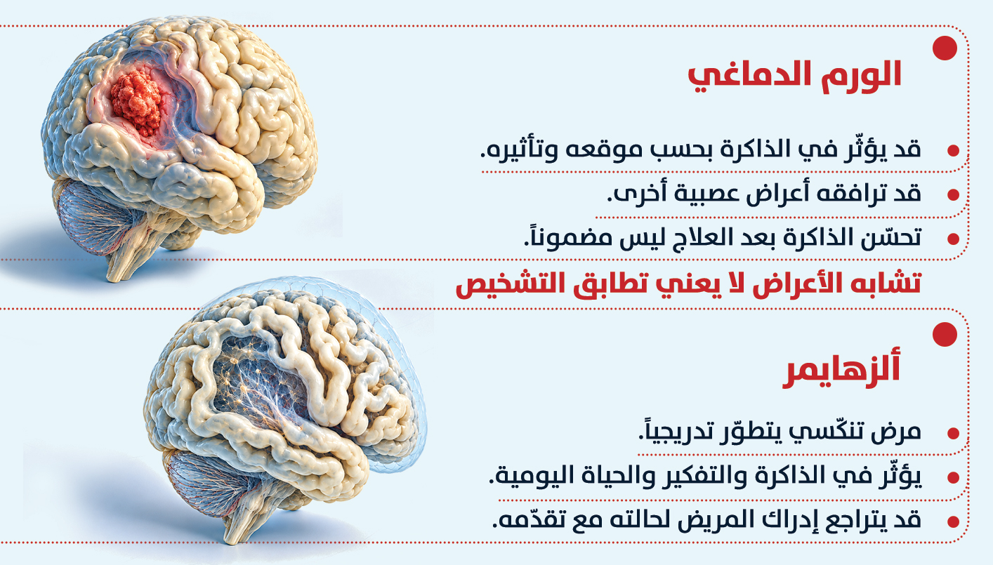 انفوغراف الفرق بين الورم في الدماغ والألزهايمر  (النهار)