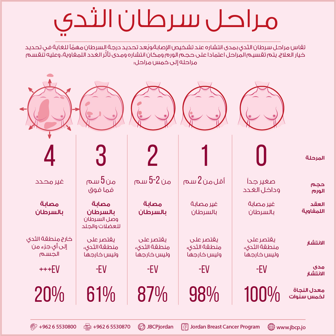 مراحل الإصابة بالسرطان (انترنت)