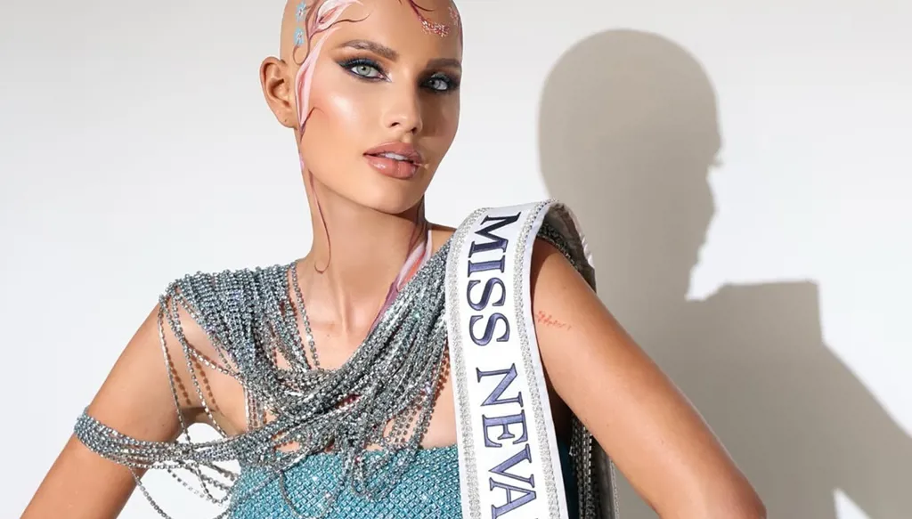 ملكة جمال أميركية... رحلة مؤثرة من فقدان شعرها ومهنتها إلى منصة التتويج (فيديو وصور)