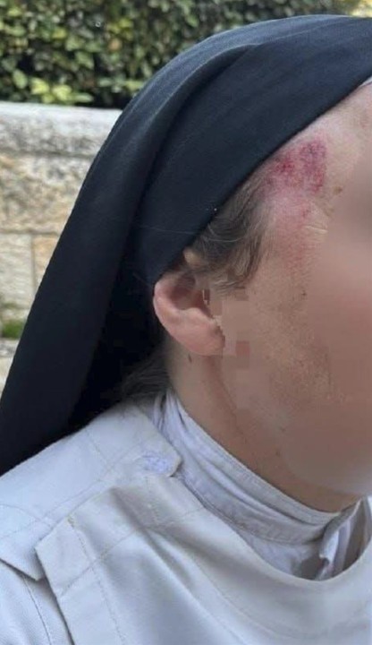 مستوطن إسرائيلي يعتدي على راهبة مسيحية في مدينة القدس بدوافع عنصرية دينية (الشرطة الإسرائيلية))
