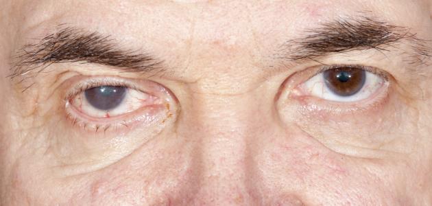  المياه الزرقاء. (تعبيرية)