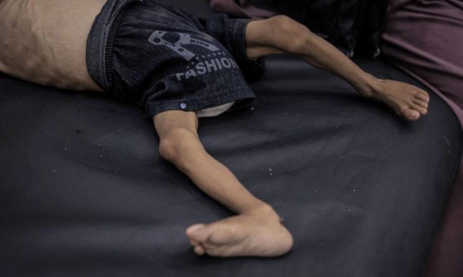 طفل في غزة يعاني متلازمة غيلان  (وكالات)