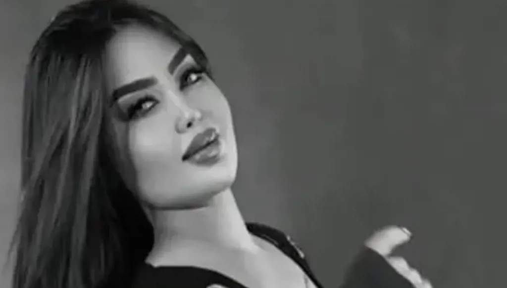 عملية تجميل تودي بحياة التيك توكر العراقية آية الياباني