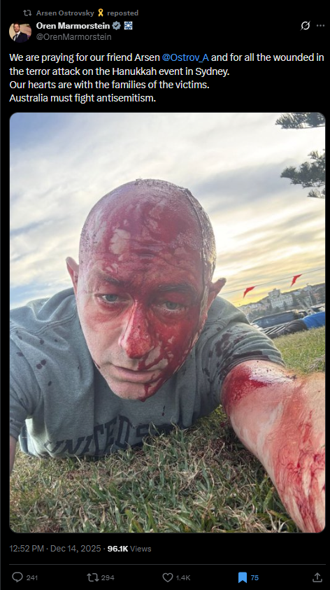 صورة أرسين أوستروفسكي مصابا نشرها أورين مارمورشتاين، المتحدث باسم وزارة الخارجية الإسرائيلية في اكس، في 14 كانون الاول 2025