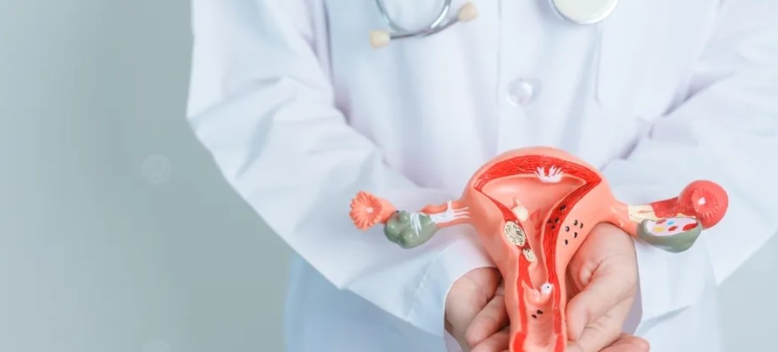 سرطان المبيض. (تعبيرية)