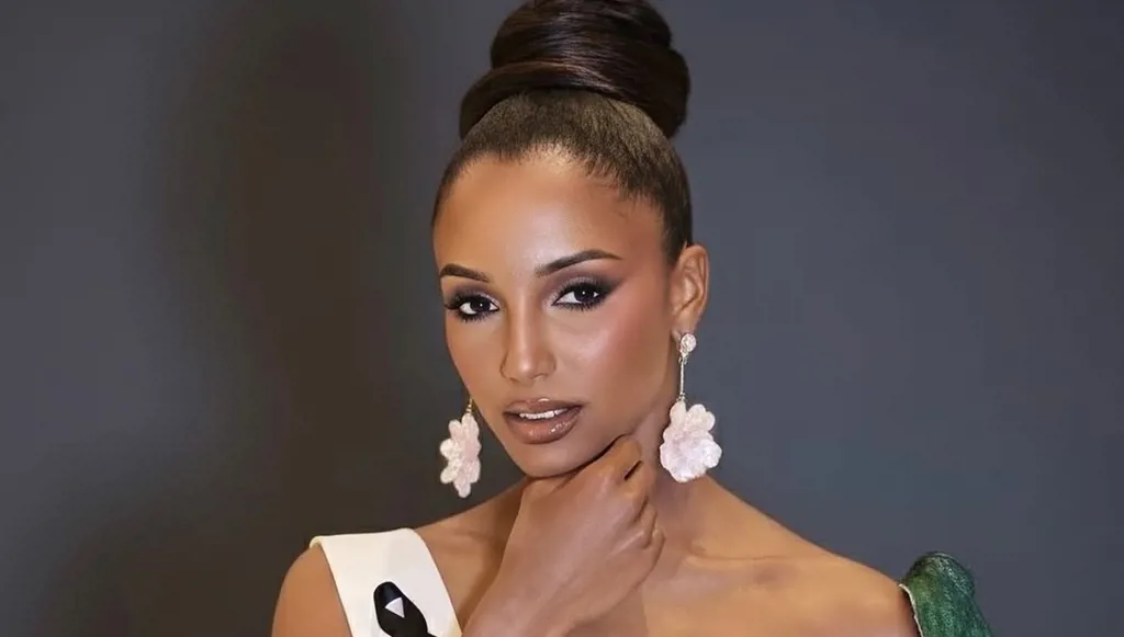 آخر مستجدات حالة ملكة جمال جامايكا الصّحية بعد سقوطها على المسرح