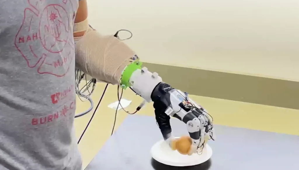 يد تعويضية مدعومة بالذكاء الاصطناعي تُقرب المستخدم من "القبضة الطبيعية"